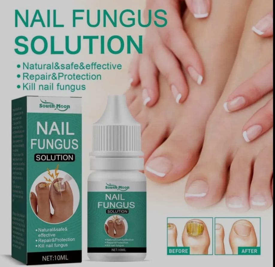 Nail Fungus Solution
