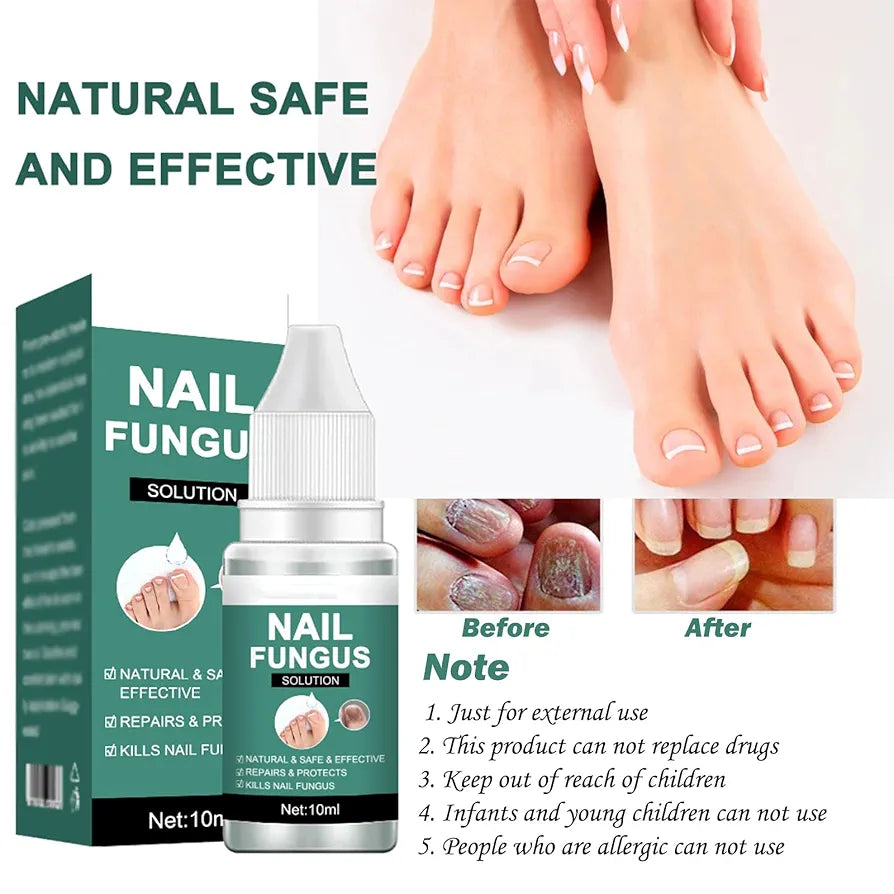 Nail Fungus Solution
