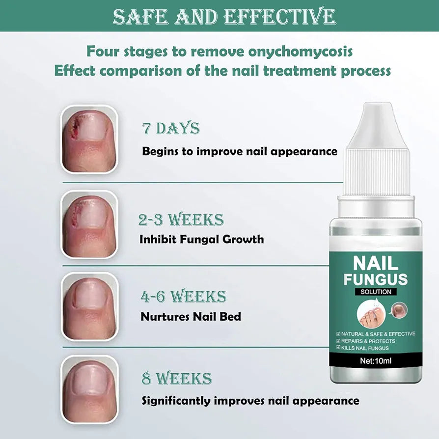 Nail Fungus Solution